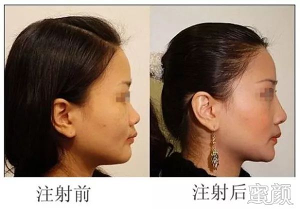https://img.miyanlife.com/mnt/timg/200103/1442555226-3.jpg