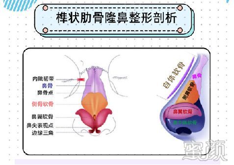 案例图片