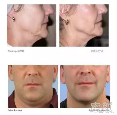 https://img.miyanlife.com/mnt/timg/200103/152A5A94-8.jpg