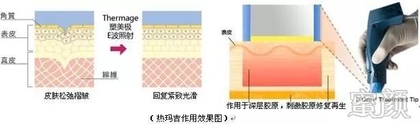 https://img.miyanlife.com/mnt/timg/200104/1449363222-1.jpg