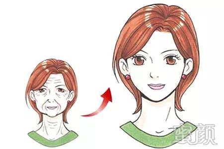 https://img.miyanlife.com/mnt/timg/200104/1453315B6-0.jpg