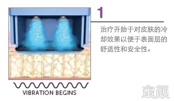 https://img.miyanlife.com/mnt/timg/200104/145332A96-2.jpg