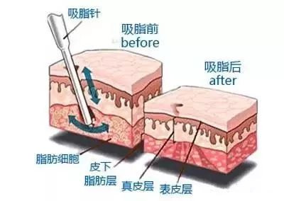 https://img.miyanlife.com/mnt/timg/200104/153T43123-1.jpg