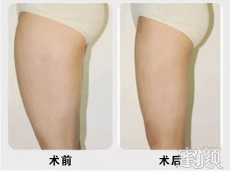 https://img.miyanlife.com/mnt/timg/200104/153T433D-0.jpg