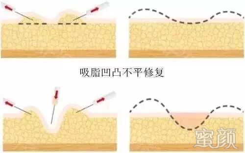 https://img.miyanlife.com/mnt/timg/200104/153T5K55-3.jpg