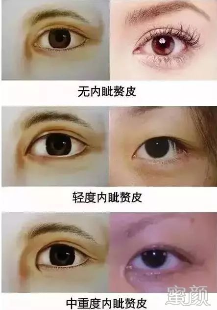 https://img.miyanlife.com/mnt/timg/200104/1630334K5-1.jpg