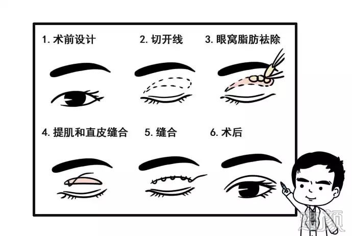 https://img.miyanlife.com/mnt/timg/200104/1630355R1-3.jpg