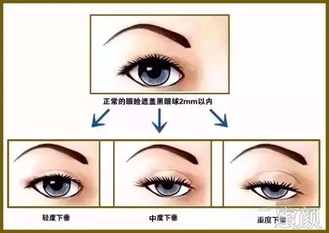 https://img.miyanlife.com/mnt/timg/200104/1630361G5-4.jpg