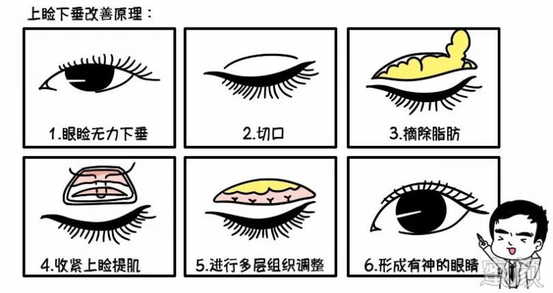 https://img.miyanlife.com/mnt/timg/200104/16303A448-5.jpg