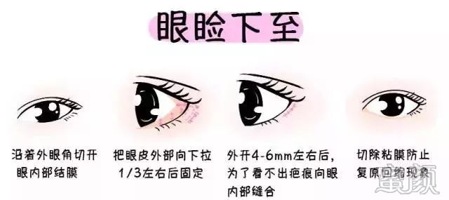 https://img.miyanlife.com/mnt/timg/200104/16303J2T-7.jpg