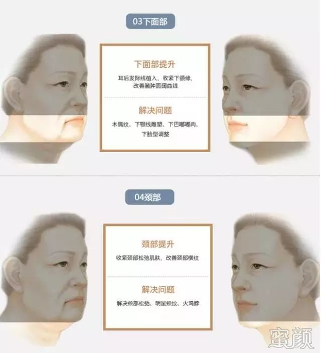 https://img.miyanlife.com/mnt/timg/200104/1631511919-10.jpg