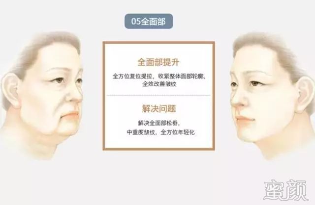 https://img.miyanlife.com/mnt/timg/200104/1631521603-11.jpg