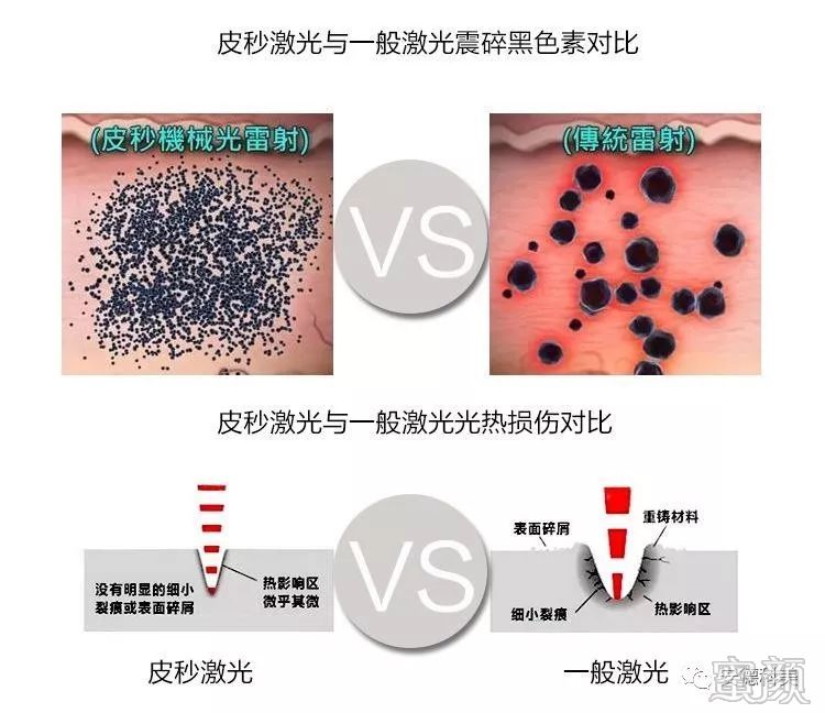https://img.miyanlife.com/mnt/timg/200104/1F95Q404-3.jpg