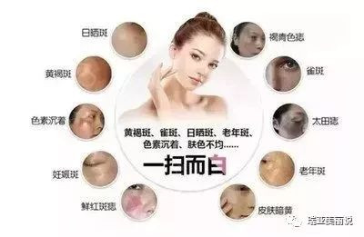 https://img.miyanlife.com/mnt/timg/200104/1G1354420-5.jpg