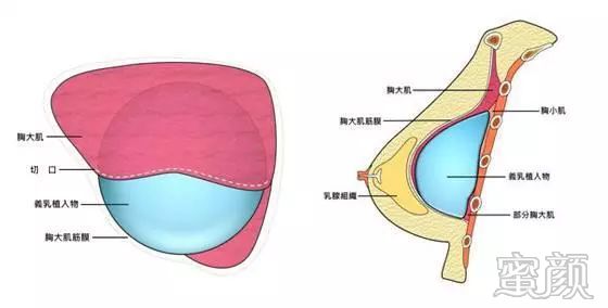 https://img.miyanlife.com/mnt/timg/200105/15533262K-4.jpg