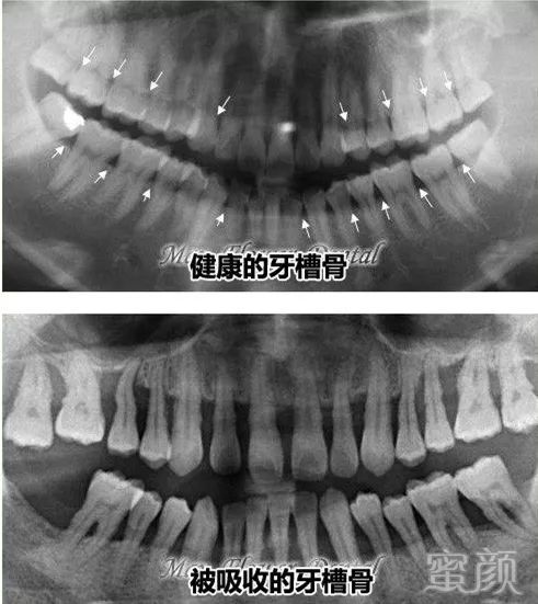 案例图片