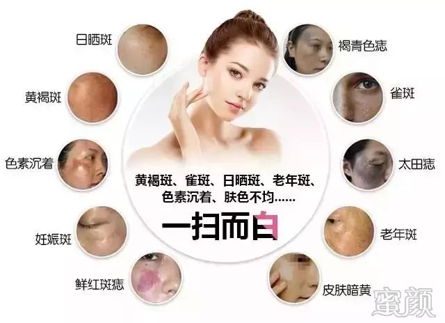 https://img.miyanlife.com/mnt/timg/200105/1631304638-4.jpg