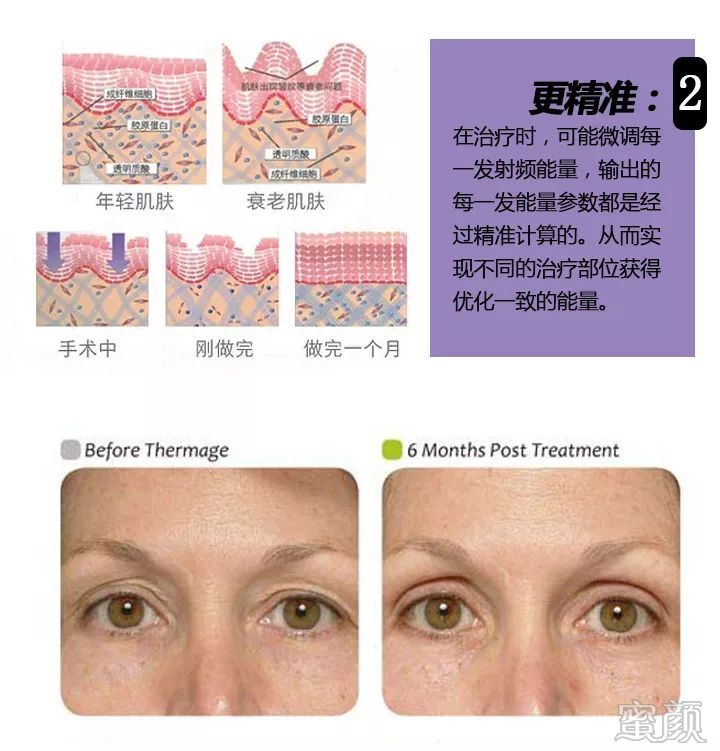 https://img.miyanlife.com/mnt/timg/200105/163UIZ2-6.jpg