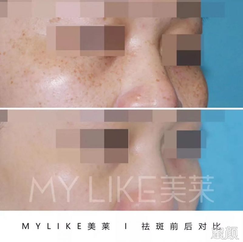 https://img.miyanlife.com/mnt/timg/200105/1A1522K4-3.jpg