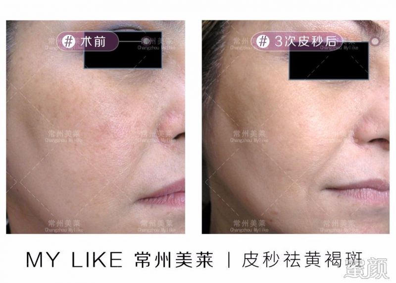 https://img.miyanlife.com/mnt/timg/200105/1A1546104-4.jpg