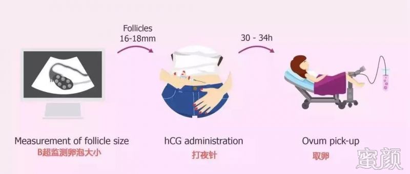 https://img.miyanlife.com/mnt/timg/200105/1F1215L9-3.jpg