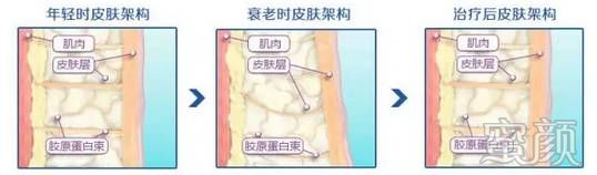 https://img.miyanlife.com/mnt/timg/200106/132T14L1-12.jpg
