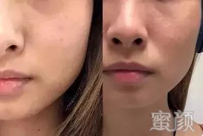 https://img.miyanlife.com/mnt/timg/200106/155132H25-8.jpg