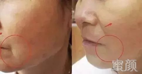 https://img.miyanlife.com/mnt/timg/200106/1551335c1-9.jpg