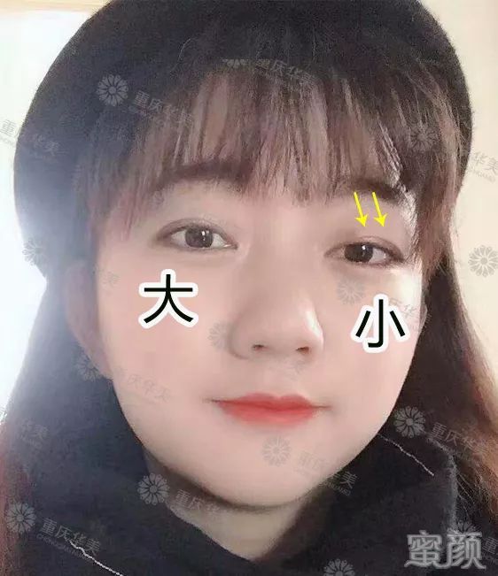 案例图片