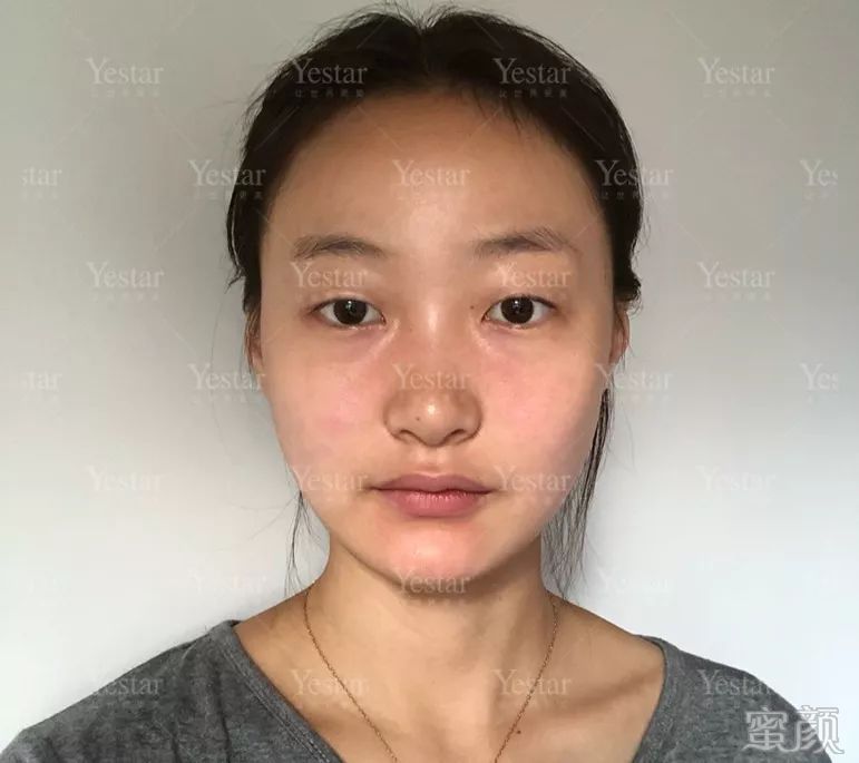 https://img.miyanlife.com/mnt/timg/200107/14033961D-7.jpg