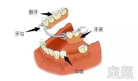 案例图片