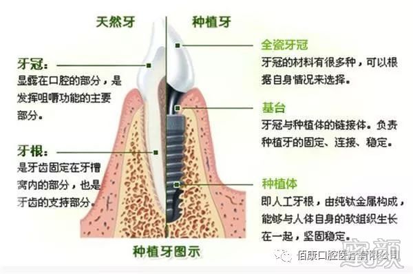 案例图片