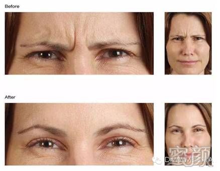https://img.miyanlife.com/mnt/timg/200107/153931F48-4.jpg