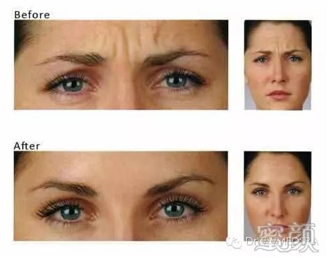 https://img.miyanlife.com/mnt/timg/200107/1539325628-5.jpg