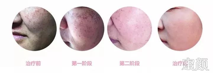 https://img.miyanlife.com/mnt/timg/200107/1555405J2-9.jpg