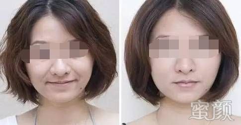 https://img.miyanlife.com/mnt/timg/200107/16122S626-3.jpg