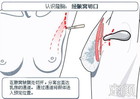 https://img.miyanlife.com/mnt/timg/200108/135453AG-7.jpg