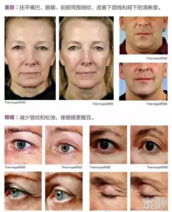 https://img.miyanlife.com/mnt/timg/200108/16064VT0-11.jpg