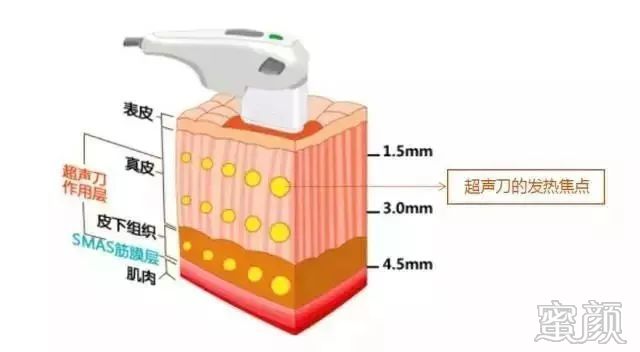 https://img.miyanlife.com/mnt/timg/200108/160H93U9-3.jpg
