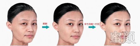 https://img.miyanlife.com/mnt/timg/200108/160I01260-4.jpg