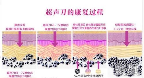https://img.miyanlife.com/mnt/timg/200108/160I06060-5.jpg