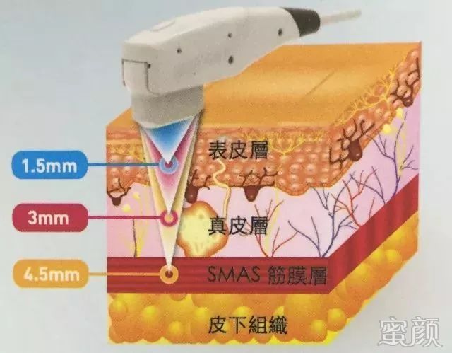 https://img.miyanlife.com/mnt/timg/200108/160I0LJ-6.jpg