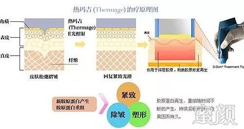 https://img.miyanlife.com/mnt/timg/200108/160I31P7-9.jpg