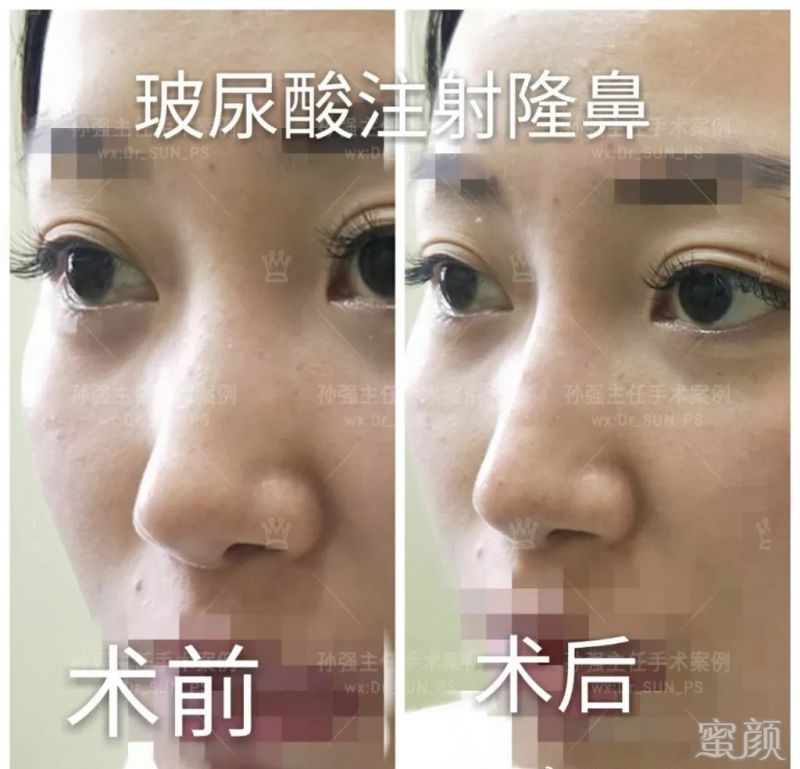 https://img.miyanlife.com/mnt/timg/200108/1626235420-3.jpg