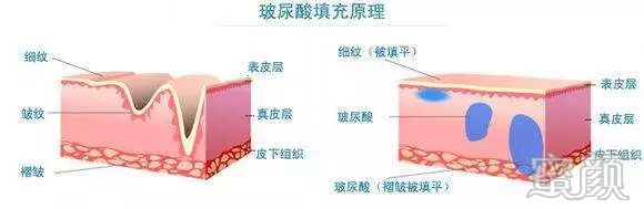 https://img.miyanlife.com/mnt/timg/200108/162623MZ-2.jpg