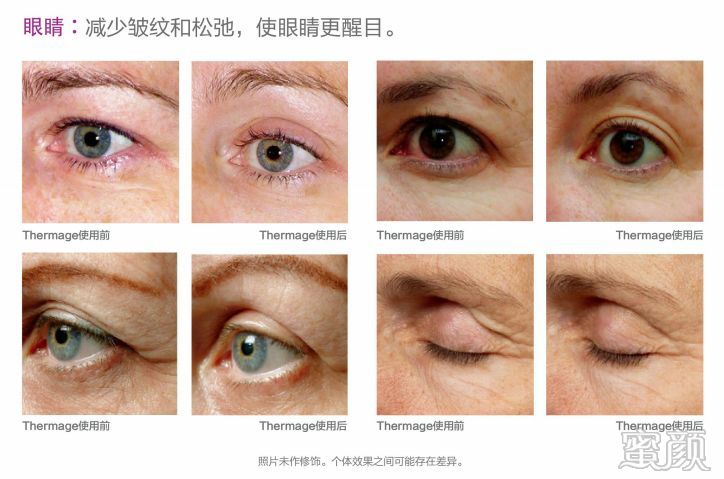 https://img.miyanlife.com/mnt/timg/200108/163K13451-8.jpg