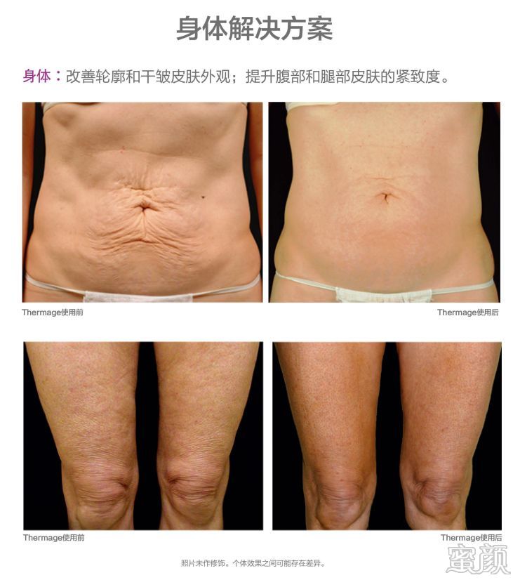 https://img.miyanlife.com/mnt/timg/200108/163K1B30-9.jpg