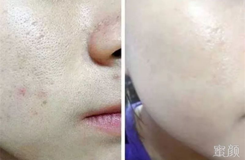 https://img.miyanlife.com/mnt/timg/200108/1A34044J-7.jpg
