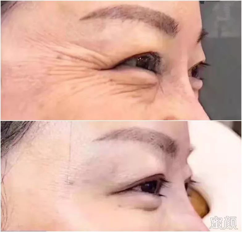 https://img.miyanlife.com/mnt/timg/200108/1A341B22-8.jpg