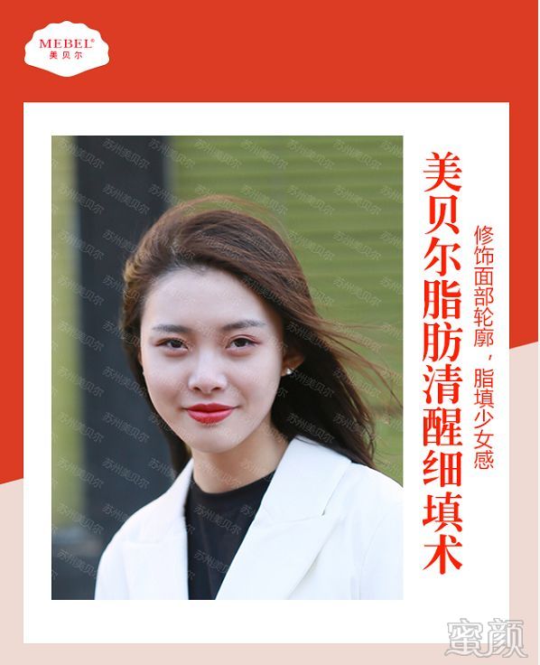https://img.miyanlife.com/mnt/timg/200109/133T5B64-0.jpg